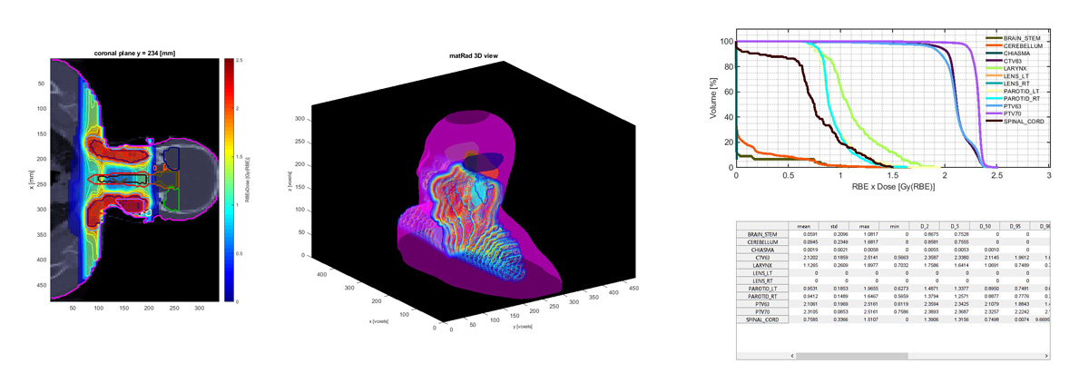 Matrad Developing matRad, an Open-Source Dose Calculation and Optimization ...
