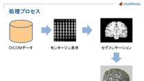 バイオイメージングや医用画像では、特徴の抽出やマッチング、統計処理などが必要とされ、必ずしも鮮明でない画像からの解析も多く要供されます。そこで、MATLABに備わっている豊富な画像処理ライブラリを組み合わせることにより、高度なバイオイメージング・医用画像処理を実現することができます。