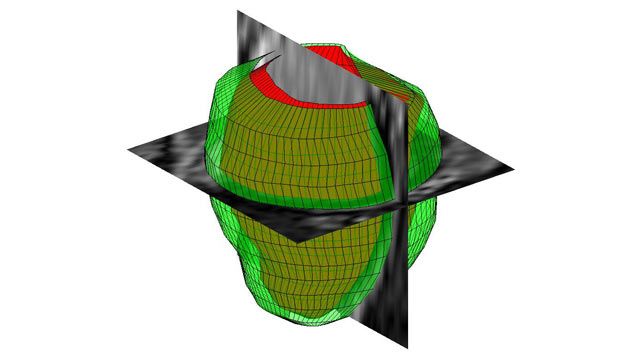 Elaborazione di immagini 3D