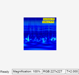 Classify ECG Signals in Simulink Using Deep Learning