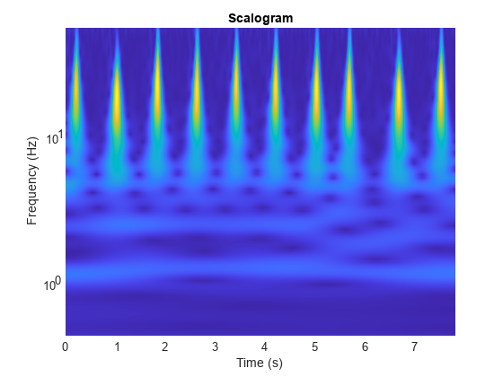 Classify ECG Signals Using DAG Network Deployed to FPGA