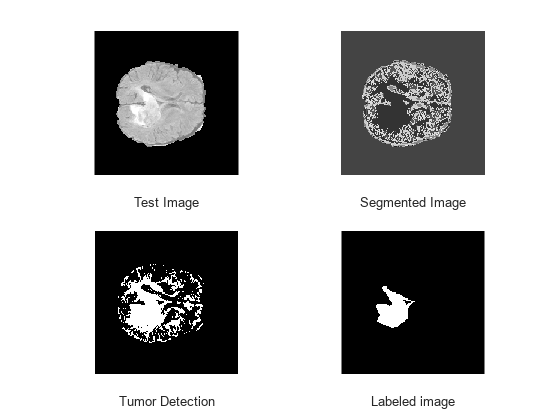Figure contains 4 axes objects. Axes object 1 with xlabel Test Image contains an object of type image. Axes object 2 with xlabel Segmented Image contains an object of type image. Axes object 3 with xlabel Tumor Detection contains an object of type image. Axes object 4 with xlabel Labeled image contains an object of type image.