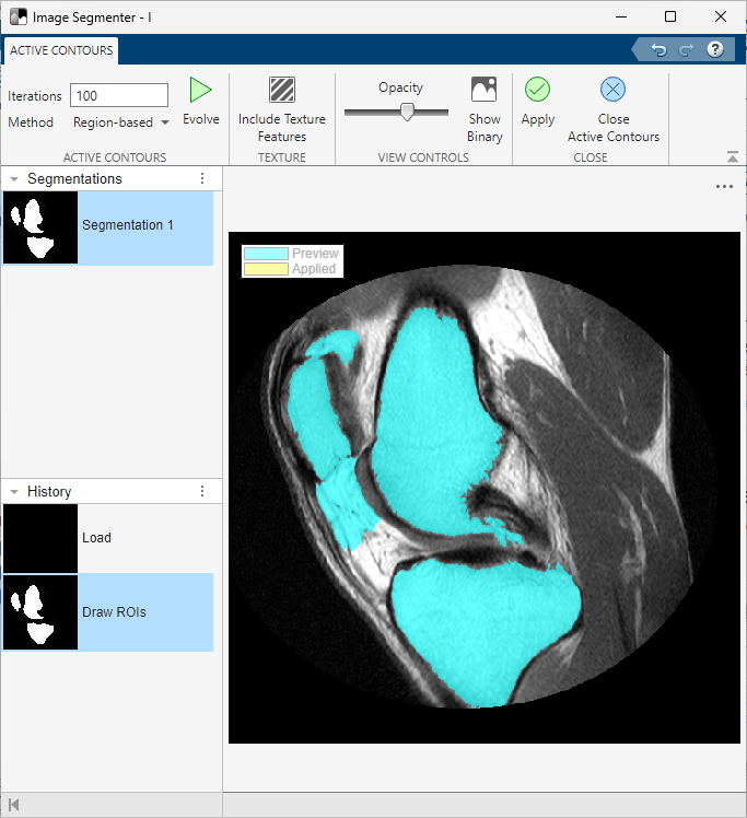 The Active Contours tab is open and the Iterations text field reads "100". There are areas where the segments have bled out past their borders during the iterating process.