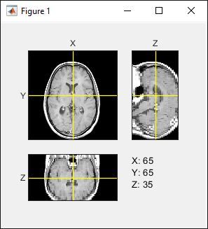 Orthoslice viewer window showing slices scaled using the ScaleFactors name-value argument