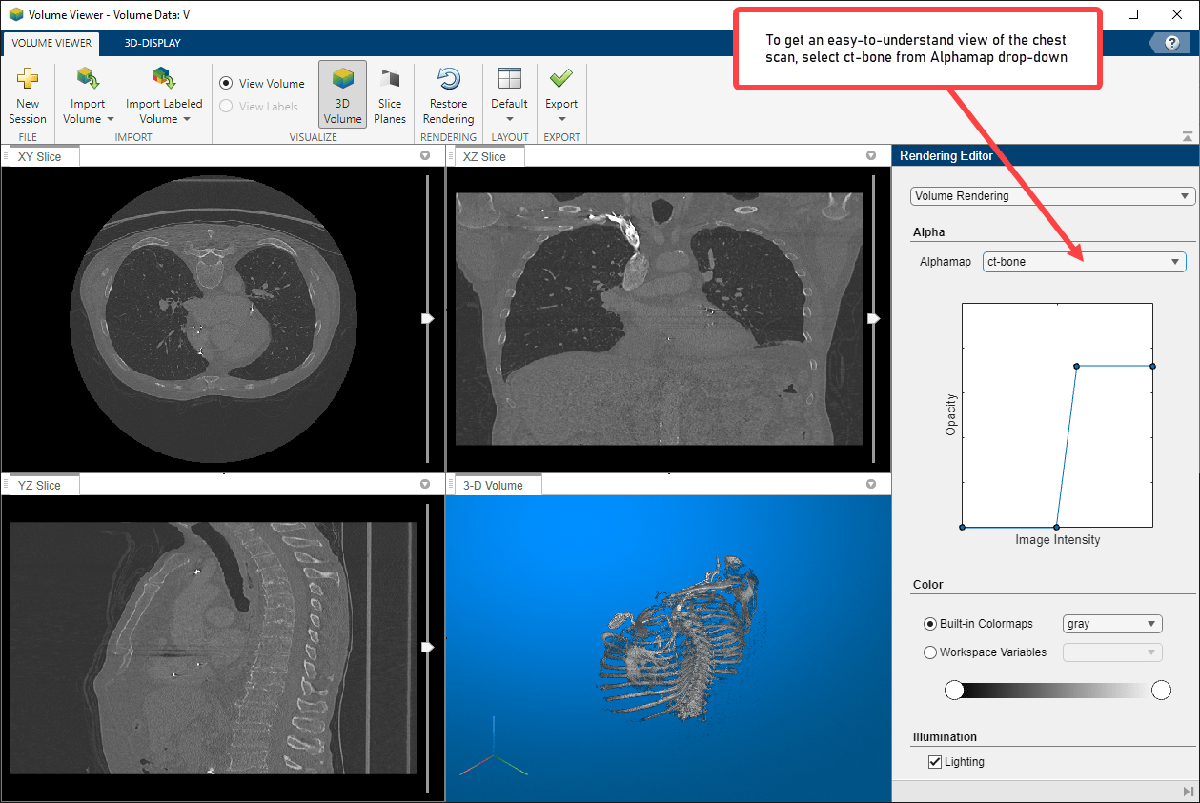 SegmentLungsFrom3DChestScanExample_01.png