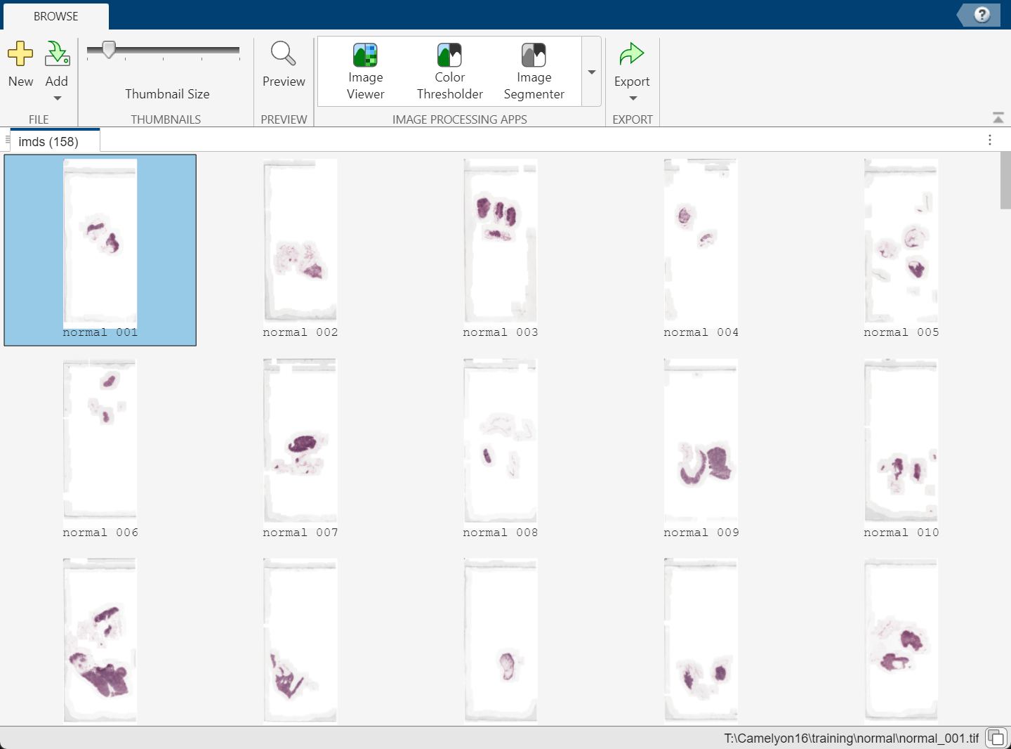 Image Browser app window showing thumbnails of the normal whole slide images