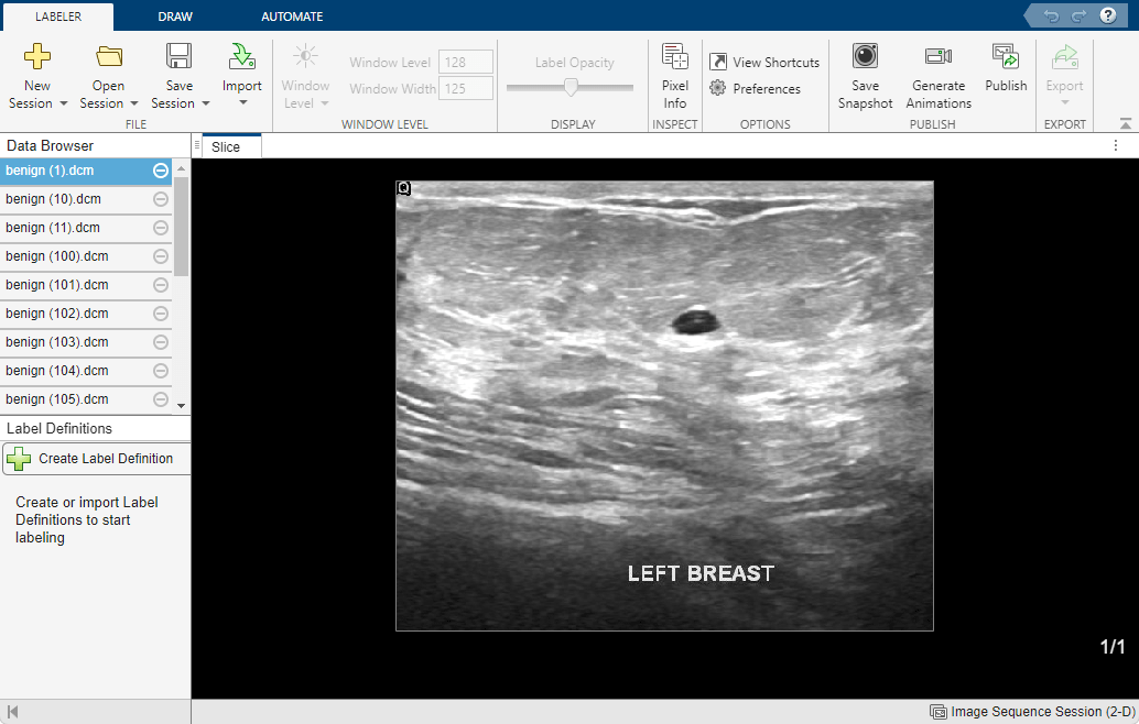 Medical Image Labeler app window with the breast ultrasound images loaded in the Data Browser