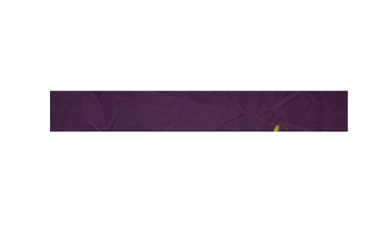 Figure contains an axes object. The hidden axes object contains an object of type image.