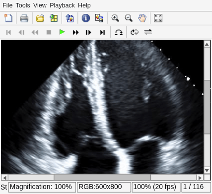Figure Movie Player contains an axes object and other objects of type uiflowcontainer, uimenu, uitoolbar. The hidden axes object contains an object of type image.
