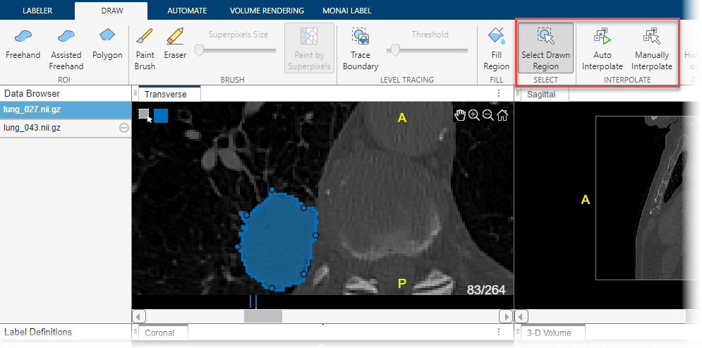 Select drawn tumor region to perform interpolation