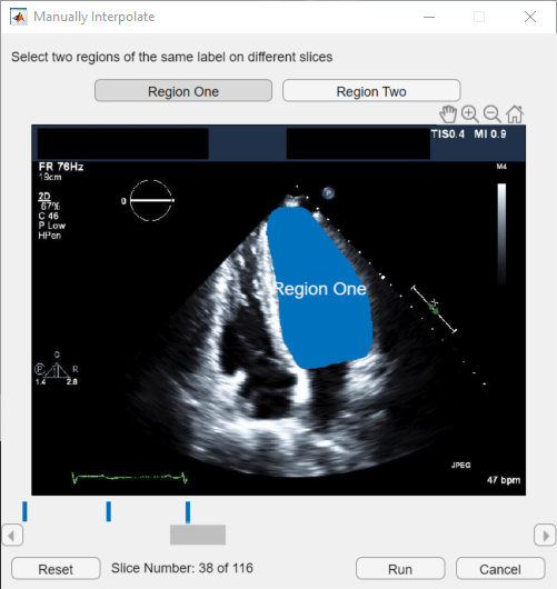 Label 2-D Ultrasound Series Using Medical Image Labeler