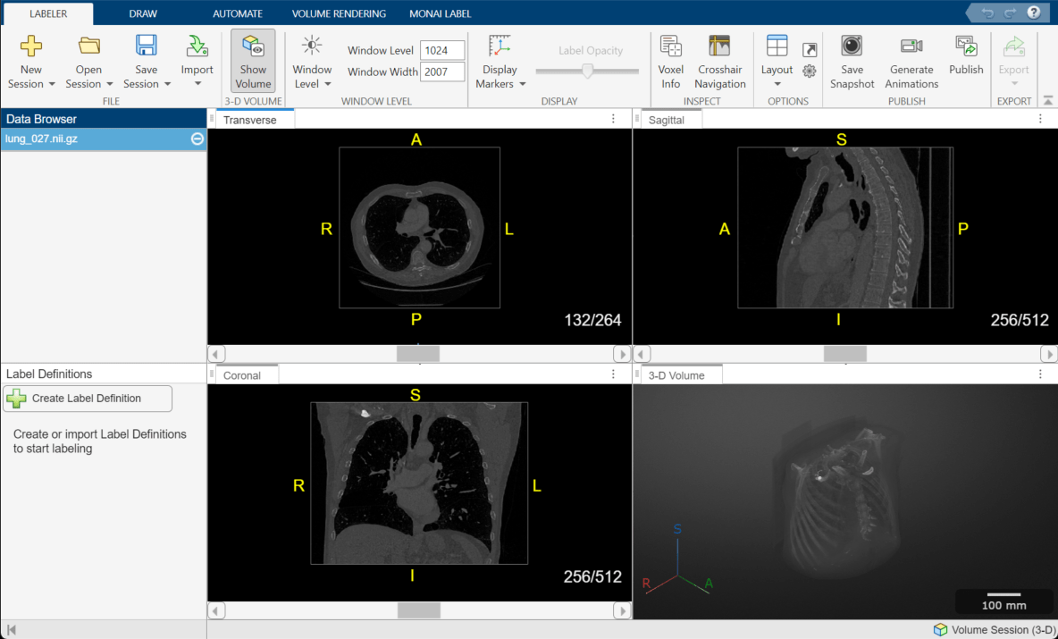 Medical Image Labeler app volume session with one chest CT scan loaded in the Data Browser