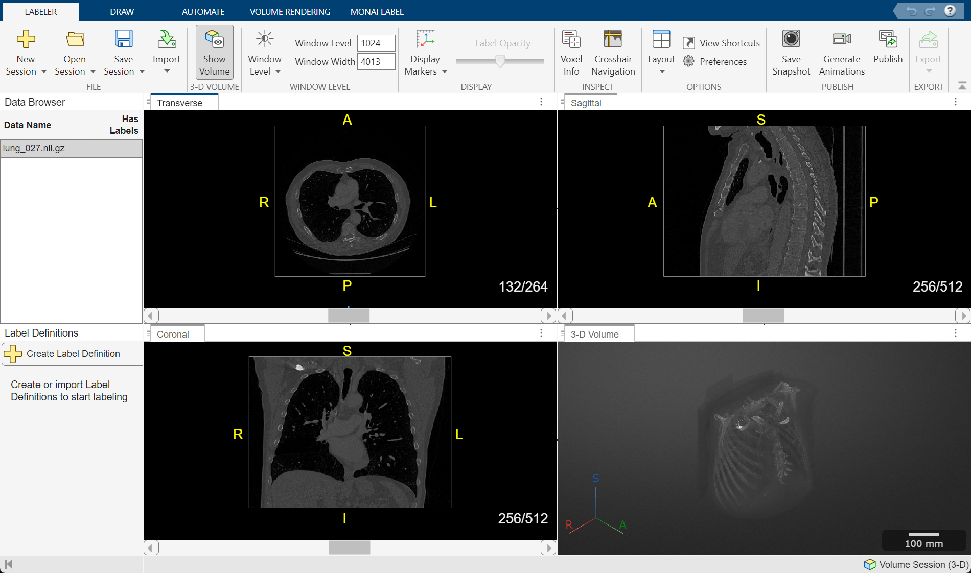 Medical Image Labeler app volume session with one chest CT scan loaded in the Data Browser