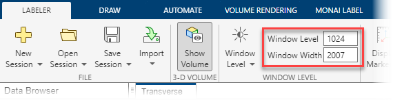 Change the image display window by typing values in the Window Level and Window Width boxes