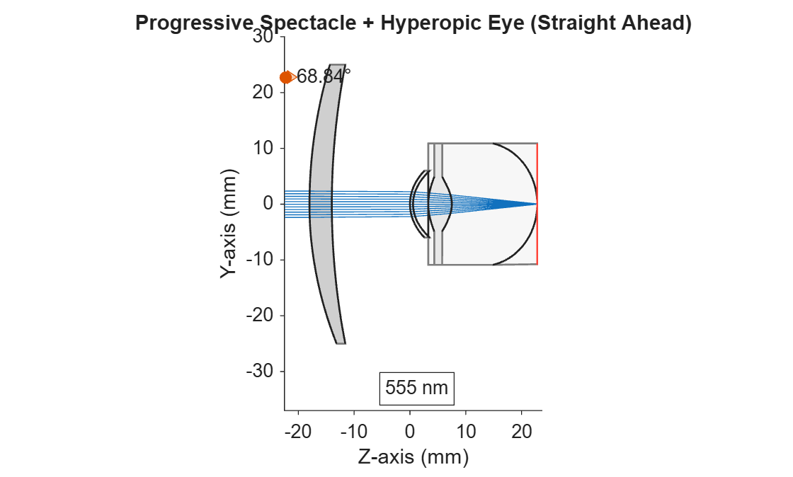 Figure contains an object of type optics.ui.opticalsystemviewer2d. The chart of type optics.ui.opticalsystemviewer2d has title Progressive Spectacle + Hyperopic Eye (Straight Ahead).