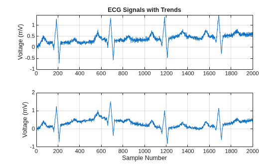 Figure contains 2 axes objects. Axes object 1 with title ECG Signals with Trends, ylabel Voltage (mV) contains an object of type line. Axes object 2 with xlabel Sample Number, ylabel Voltage (mV) contains an object of type line.