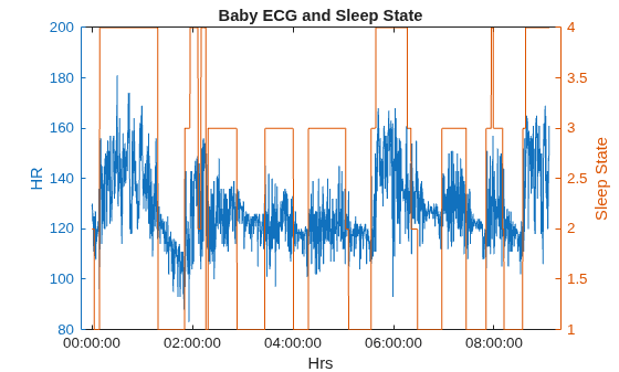 Figure contains an axes object. The axes object with title Baby ECG and Sleep State, xlabel Hrs, ylabel Sleep State contains 2 objects of type line.