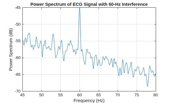 Figure contains an axes object. The axes object with title Power Spectrum of ECG Signal with 60-Hz Interference, xlabel Frequency (Hz), ylabel Power Spectrum (dB) contains an object of type line.