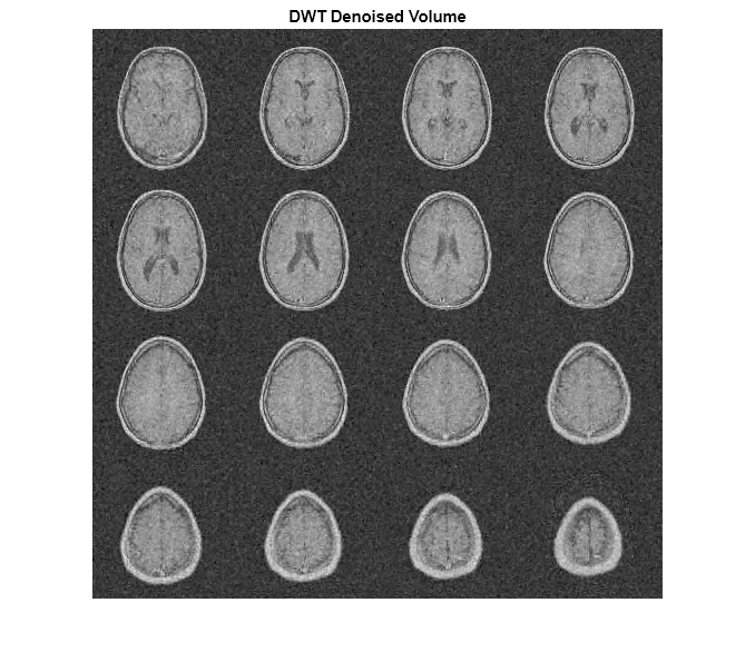 Dual-Tree Complex Wavelet Transforms