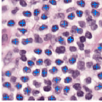 Blue plus markers overlaid on a histology image of stained cells