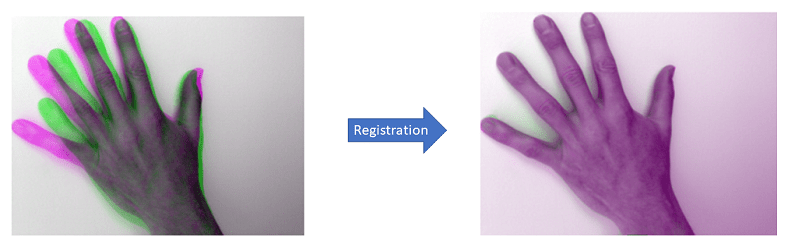 Deformable Registration