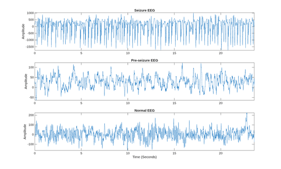 Epilepsy EEG data set. The figure shows three signals in the time domain.