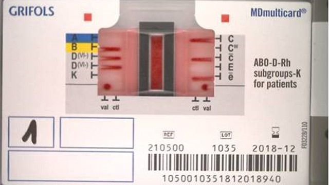 IDNEO sviluppa algoritmi embedded di visione artificiale e Machine Learning per l’interpretazione dei risultati di analisi del gruppo sanguigno