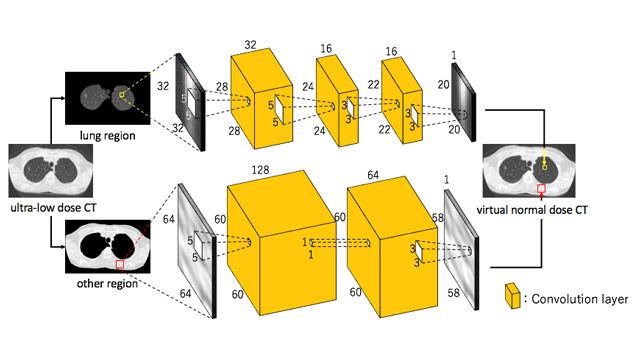 Utilizzo del Deep Learning per ridurre il rischio di esposizione alle radiazioni nell'imaging TC